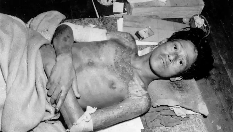 Nagasaki'den Gelen Uyarı: Nükleer Tehditler Artıyor, Dikkat!