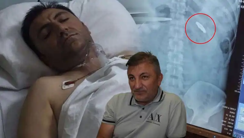 15 Temmuz’un Gölgesinde: Kurşunla Yaralanan Şahidin Hikayesi